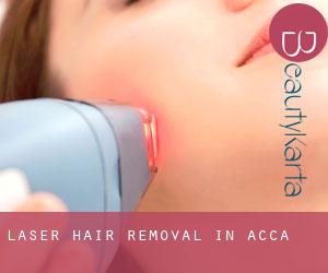 Laser Hair removal in Acca