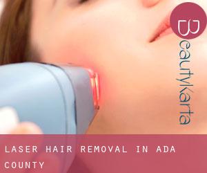 Laser Hair removal in Ada County