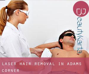 Laser Hair removal in Adams Corner