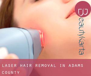 Laser Hair removal in Adams County