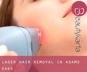 Laser Hair removal in Adams Oaks