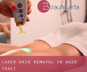 Laser Hair removal in Ager Tract