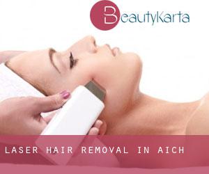 Laser Hair removal in Aich