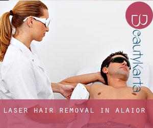 Laser Hair removal in Alaior