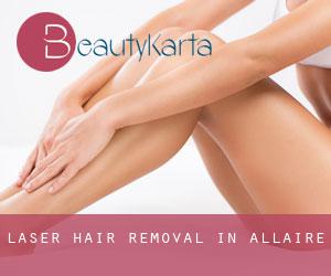 Laser Hair removal in Allaire