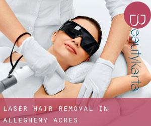 Laser Hair removal in Allegheny Acres