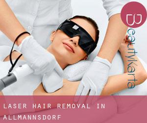 Laser Hair removal in Allmannsdorf