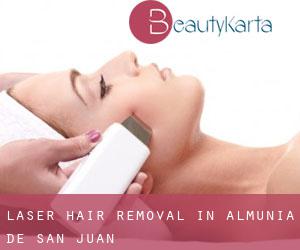 Laser Hair removal in Almunia de San Juan