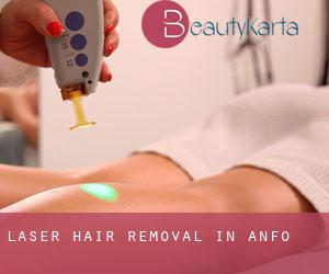 Laser Hair removal in Anfo