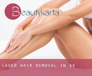 Laser Hair removal in Ås