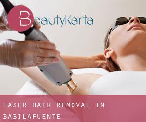 Laser Hair removal in Babilafuente