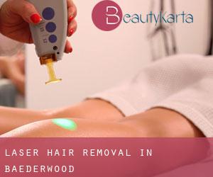 Laser Hair removal in Baederwood