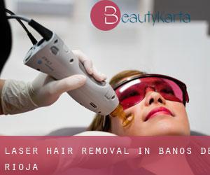 Laser Hair removal in Baños de Rioja