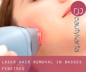 Laser Hair removal in Basses Fenêtres