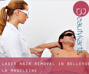 Laser Hair removal in Bellevue - La Madeleine