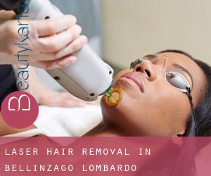 Laser Hair removal in Bellinzago Lombardo