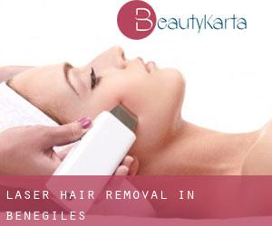Laser Hair removal in Benegiles