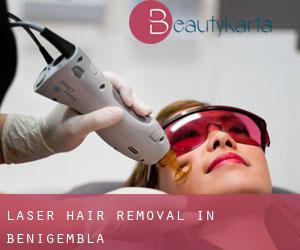 Laser Hair removal in Benigembla