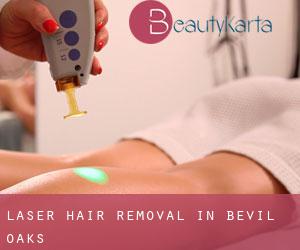 Laser Hair removal in Bevil Oaks