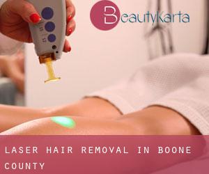 Laser Hair removal in Boone County