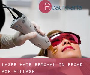 Laser Hair removal in Broad Axe Village