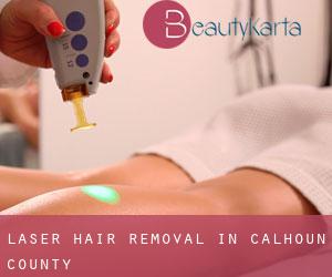 Laser Hair removal in Calhoun County