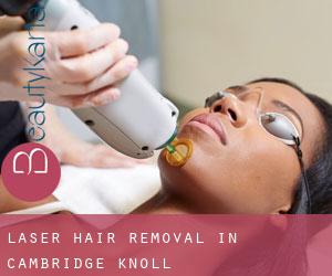 Laser Hair removal in Cambridge Knoll