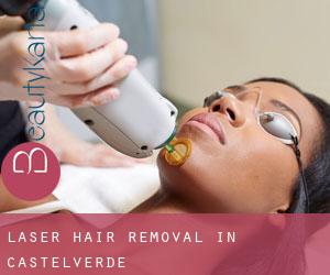 Laser Hair removal in Castelverde