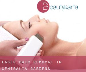 Laser Hair removal in Centralia Gardens