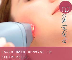 Laser Hair removal in Centreville