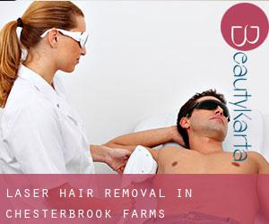 Laser Hair removal in Chesterbrook Farms