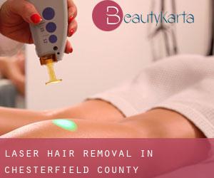 Laser Hair removal in Chesterfield County