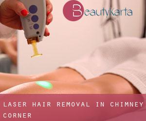 Laser Hair removal in Chimney Corner