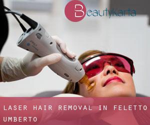 Laser Hair removal in Feletto Umberto