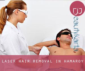 Laser Hair removal in Hamarøy