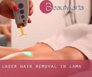 Laser Hair removal in Lama