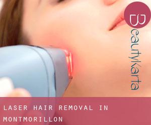 Laser Hair removal in Montmorillon