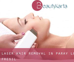 Laser Hair removal in Paray-le-Frésil