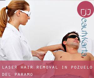 Laser Hair removal in Pozuelo del Páramo