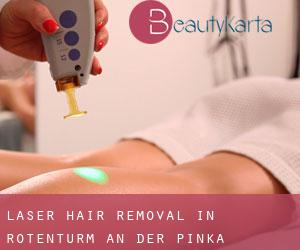 Laser Hair removal in Rotenturm an der Pinka