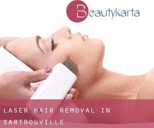 Laser Hair removal in Sartrouville