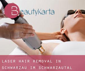 Laser Hair removal in Schwarzau im Schwarzautal