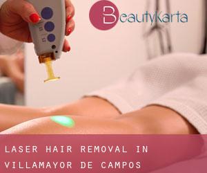 Laser Hair removal in Villamayor de Campos