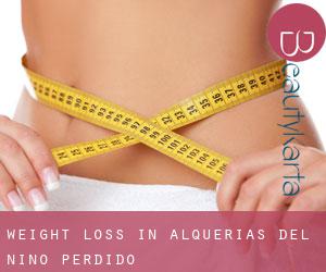 Weight Loss in Alquerías del Niño Perdido