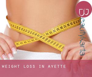 Weight Loss in Ayette