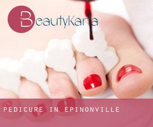 Pedicure in Épinonville