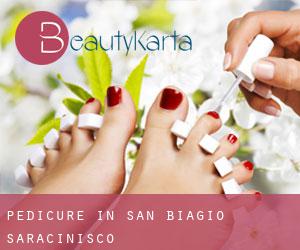 Pedicure in San Biagio Saracinisco