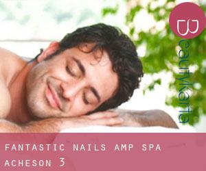 Fantastic Nails & spa (Acheson) #3